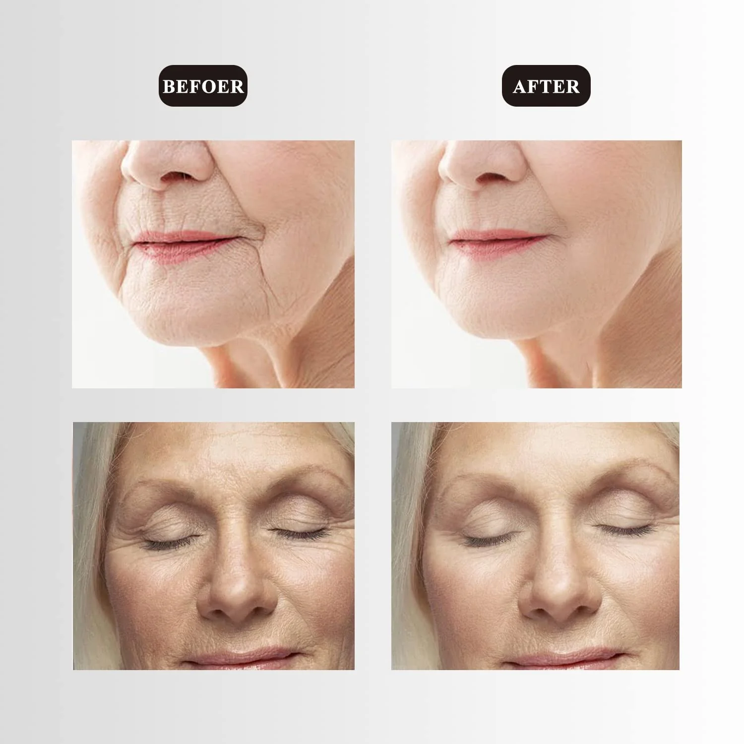 Ms.W Electric Red Light Face Massager for Face and Neck