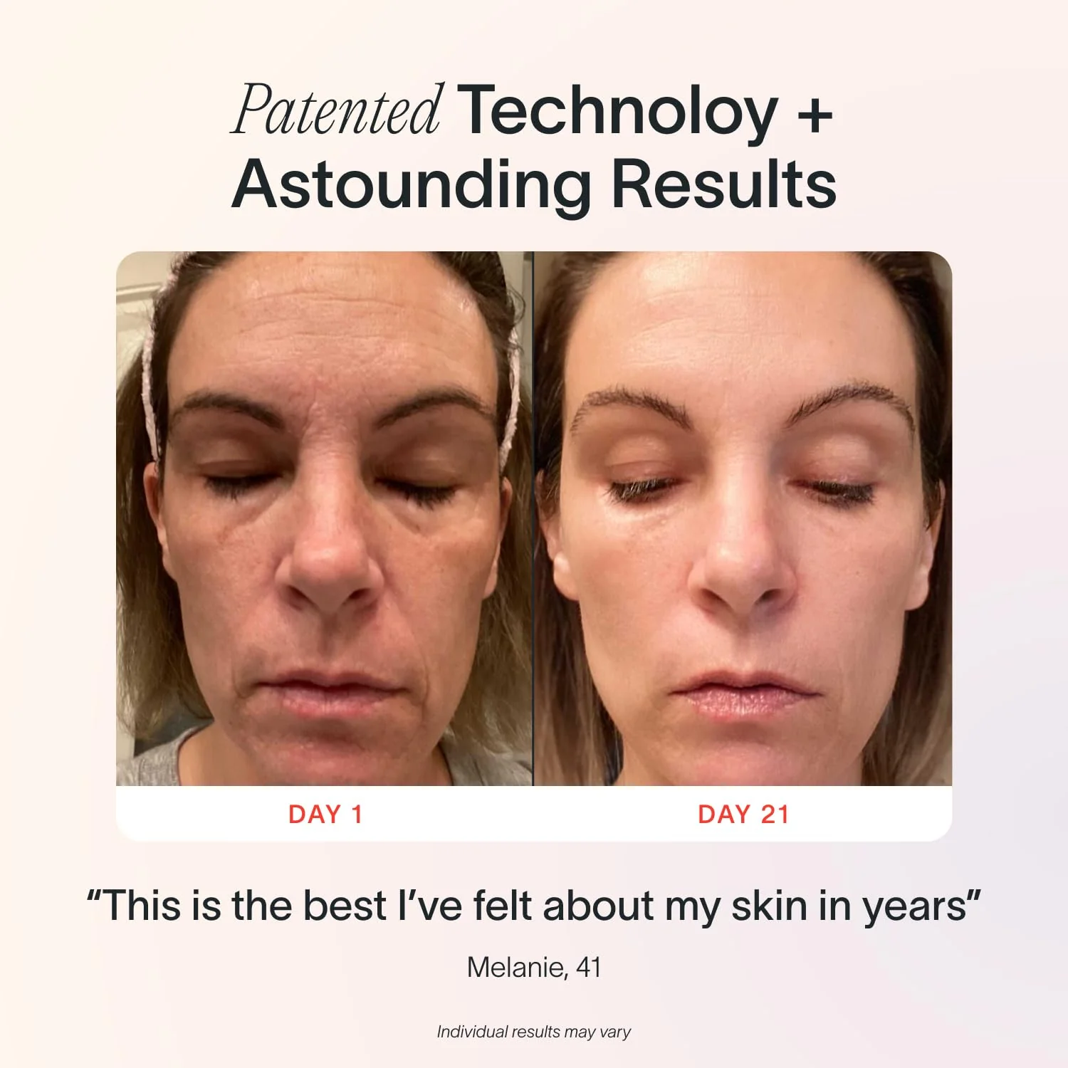 Solawave 4-in-1 Radiant Renewal Wand with Facial Massager